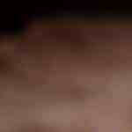 buñuelos de rodilla