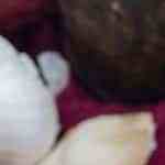 plato con albóndigas de garbanzos