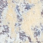 Muslos de pollo a la jardinera